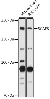 Western blot analysis of extracts of various cell lines using SCAF8 Polyclonal Antibody at 1:1000 dilution.