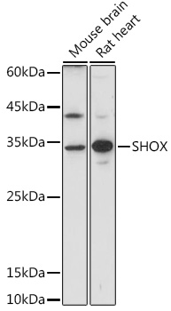 Western blot analysis of extracts of various cell lines using SHOX Polyclonal Antibody at 1:1000 dilution.