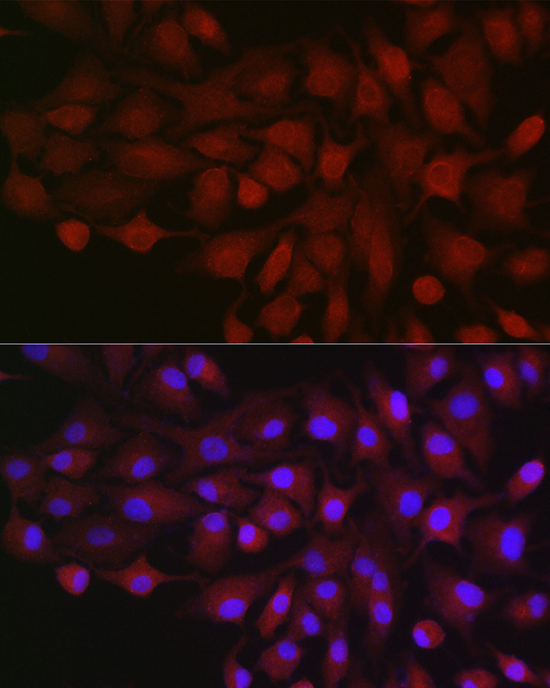 Immunofluorescence analysis of A549 cells using BDKRB1 Polyclonal Antibody at dilution of 1:200 (40x lens). Blue: DAPI for nuclear staining.