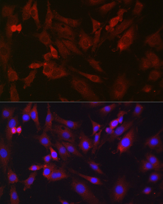 Immunofluorescence analysis of C6 cells using BDKRB1 Polyclonal Antibody at dilution of 1:200 (40x lens). Blue: DAPI for nuclear staining.