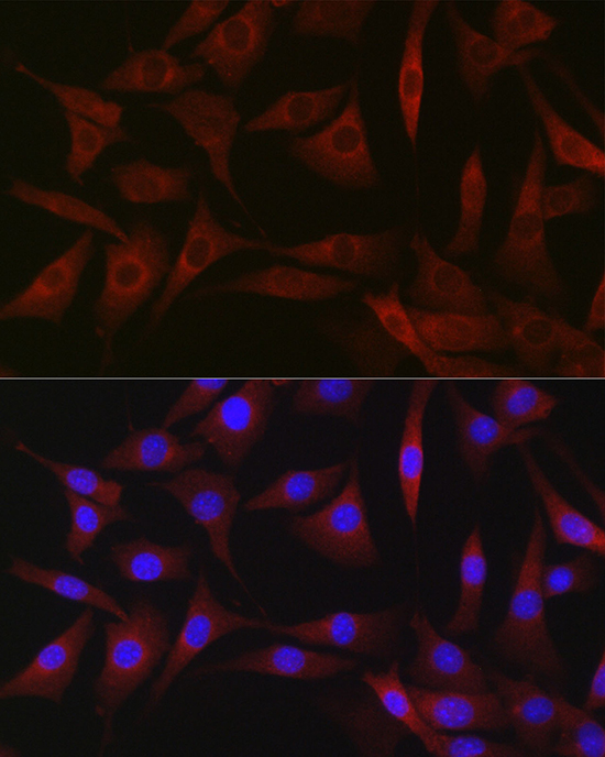 Immunofluorescence analysis of NIH-3T3 cells using BDKRB1 Polyclonal Antibody at dilution of 1:200 (40x lens). Blue: DAPI for nuclear staining.