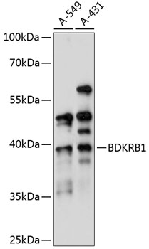 Western blot analysis of extracts of various cell lines using BDKRB1 Polyclonal Antibody at 1:1000 dilution.