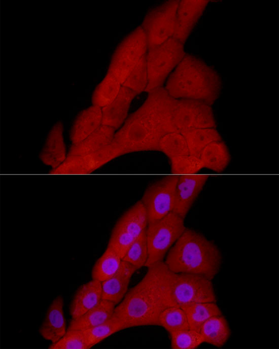 Immunofluorescence analysis of A-431 cells using PRDM1 Polyclonal Antibody at dilution of 1:50 (40x lens). Blue: DAPI for nuclear staining.