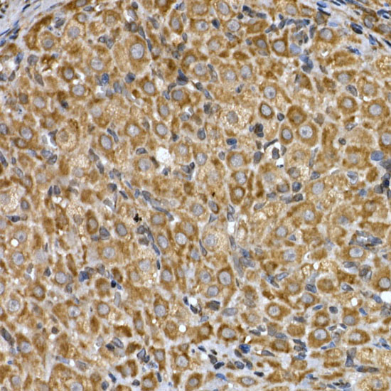 Immunohistochemistry of paraffin-embedded rat ovary using INSIG2 Polyclonal Antibody at dilution of 1:200 (40x lens).Perform high pressure antigen retrieval with 10 mM citrate buffer pH 6.0 before commencing with IHC staining protocol.