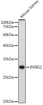 Western blot analysis of extracts of Mouse kidney using INSIG2 Polyclonal Antibody at 1:1000 dilution.