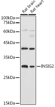 Western blot analysis of extracts of various cell lines using INSIG2 Polyclonal Antibody at 1:1000 dilution.