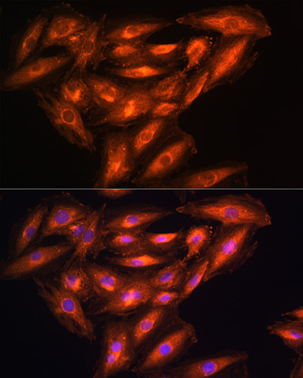 Immunofluorescence analysis of H9C2 cells using PHGDH Polyclonal Antibody at dilution of 1:100. Blue: DAPI for nuclear staining.