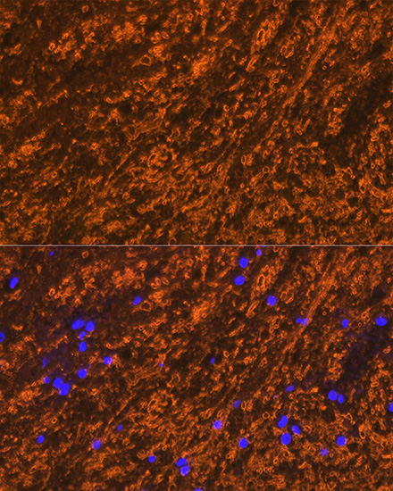 Immunofluorescence analysis of rat brain cells using PLP1 Polyclonal Antibody at dilution of 1:100 (40x lens). Blue: DAPI for nuclear staining.