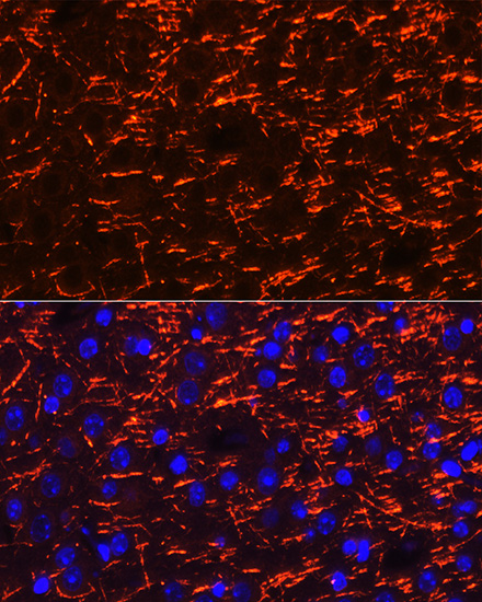 Immunofluorescence analysis of mouse brain cells using PLP1 Polyclonal Antibody at dilution of 1:100 (40x lens). Blue: DAPI for nuclear staining.