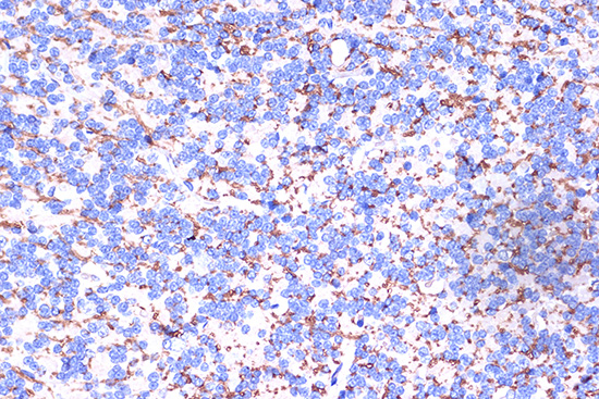 Immunohistochemistry of paraffin-embedded rat brain using PLP1 Polyclonal Antibody at dilution of 1:100 (40x lens).Perform microwave antigen retrieval with 10 mM PBS buffer pH 7.2 before commencing with IHC staining protocol.