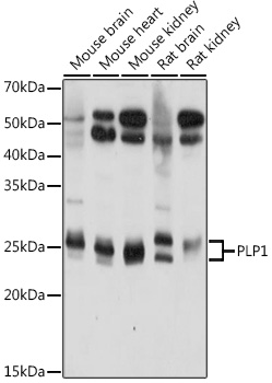 Western blot analysis of extracts of various cell lines using PLP1 Polyclonal Antibody at 1:1000 dilution.