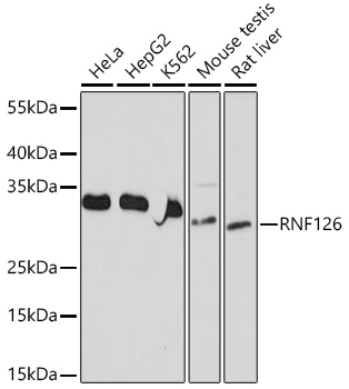 Western blot analysis of extracts of various cell lines using RNF126 Polyclonal Antibody at 1:1000 dilution.