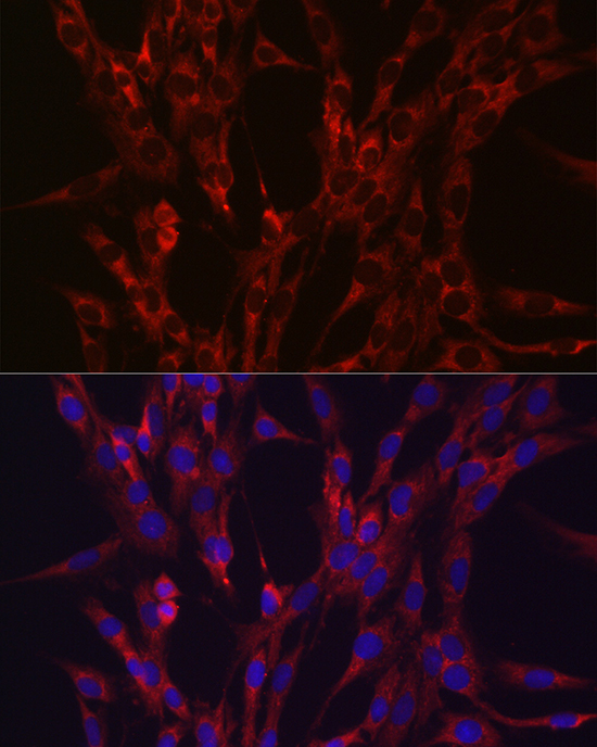 Immunofluorescence analysis of C6 cells using HIF3A Polyclonal Antibody at dilution of 1:100 (40x lens). Blue: DAPI for nuclear staining.