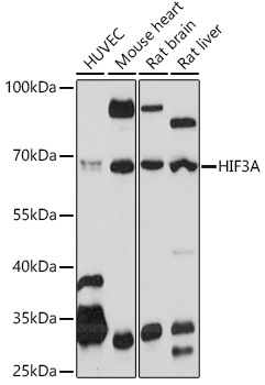 Western blot analysis of extracts of various cell lines using HIF3A Polyclonal Antibody at 1:1000 dilution.