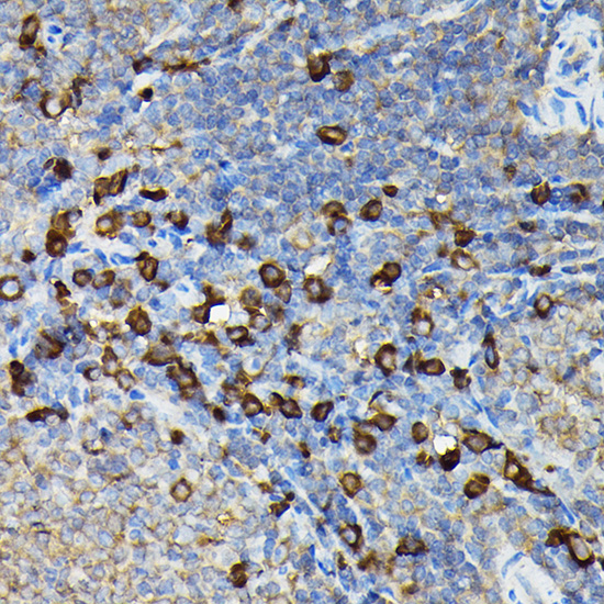 Immunohistochemistry of paraffin-embedded rat spleen using FAM117A Polyclonal Antibody at dilution of 1:100 (40x lens).Perform high pressure antigen retrieval with 10 mM citrate buffer pH 6.0 before commencing with IHC staining protocol.