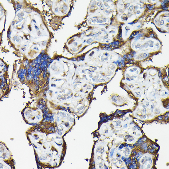 Immunohistochemistry of paraffin-embedded human placenta using FAM117A Polyclonal Antibody at dilution of 1:100 (40x lens).Perform high pressure antigen retrieval with 10 mM citrate buffer pH 6.0 before commencing with IHC staining protocol.