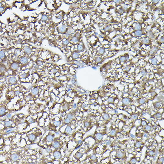 Immunohistochemistry of paraffin-embedded mouse liver using FAM117A Polyclonal Antibody at dilution of 1:100 (40x lens).Perform high pressure antigen retrieval with 10 mM citrate buffer pH 6.0 before commencing with IHC staining protocol.