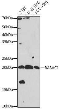 Western blot analysis of extracts of various cell lines using RABAC1 Polyclonal Antibody at 1:1000 dilution.