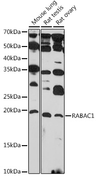 Western blot analysis of extracts of various cell lines using RABAC1 Polyclonal Antibody at 1:1000 dilution.