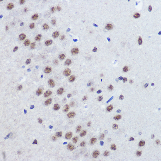 Immunohistochemistry of paraffin-embedded rat brain using JMJD1C Polyclonal Antibody at dilution of 1:100 (40x lens).Perform microwave antigen retrieval with 10 mM PBS buffer pH 7.2 before commencing with IHC staining protocol.