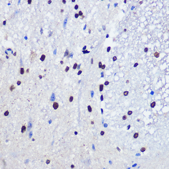 Immunohistochemistry of paraffin-embedded mouse spinal cord using JMJD1C Polyclonal Antibody at dilution of 1:100 (40x lens).Perform microwave antigen retrieval with 10 mM PBS buffer pH 7.2 before commencing with IHC staining protocol.