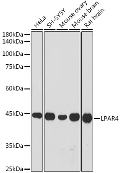 Western blot analysis of extracts of various cell lines using LPAR4 Polyclonal Antibody at 1:1000 dilution.