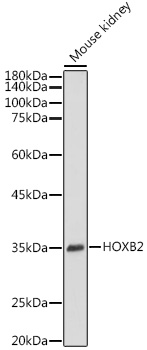 Western blot analysis of extracts of Mouse kidney using HOXB2 Polyclonal Antibody at 1:1000 dilution.