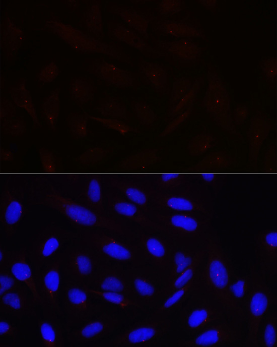 Immunofluorescence analysis of U2OS cells using PCNT Polyclonal Antibody at dilution of 1:100 (40x lens). Blue: DAPI for nuclear staining.