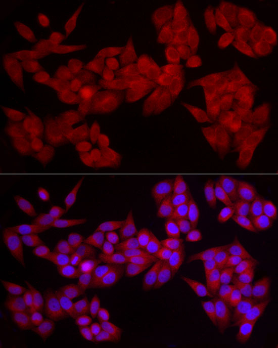 Immunofluorescence analysis of HeLa cells using PDE4A Polyclonal Antibody at dilution of 1:20 (40x lens). Blue: DAPI for nuclear staining.