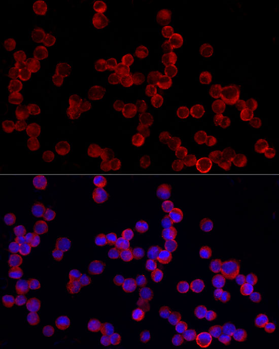 Immunofluorescence analysis of K-562 cells using PDE4A Polyclonal Antibody at dilution of 1:20 (40x lens). Blue: DAPI for nuclear staining.