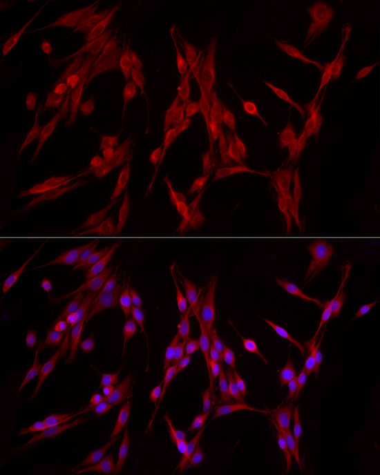 Immunofluorescence analysis of PC-12 cells using PDE4A Polyclonal Antibody at dilution of 1:20 (40x lens). Blue: DAPI for nuclear staining.