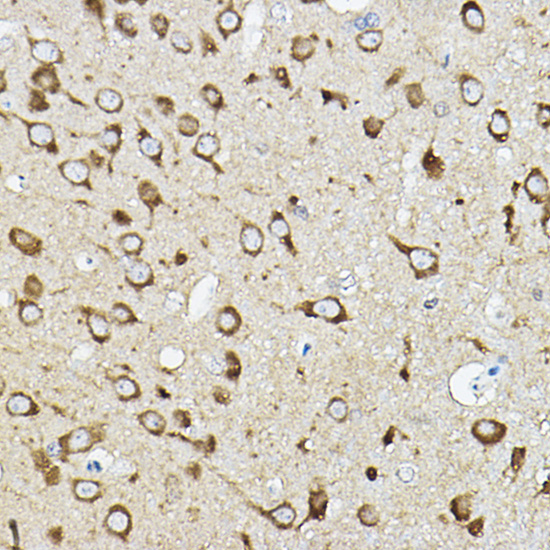 Immunohistochemistry of paraffin-embedded rat brain using ATP6V1G2 Polyclonal Antibody at dilution of 1:50 (40x lens).Perform high pressure antigen retrieval with 10 mM citrate buffer pH 6.0 before commencing with IHC staining protocol.