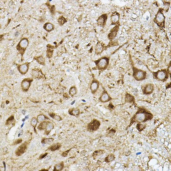 Immunohistochemistry of paraffin-embedded mouse spinal cord using ATP6V1G2 Polyclonal Antibody at dilution of 1:50 (40x lens).Perform high pressure antigen retrieval with 10 mM citrate buffer pH 6.0 before commencing with IHC staining protocol.