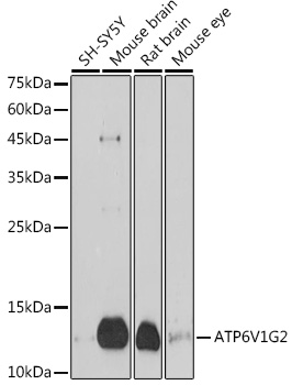 Western blot analysis of extracts of various cell lines using ATP6V1G2 Polyclonal Antibody at 1:1000 dilution.