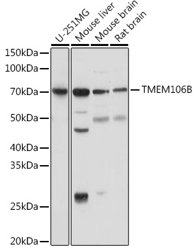 Western blot analysis of extracts of various cell lines using TMEM106B Polyclonal Antibody at 1:1000 dilution.