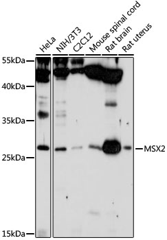 Western blot analysis of extracts of various cell lines using MSX2 Polyclonal Antibody at 1:1000 dilution.