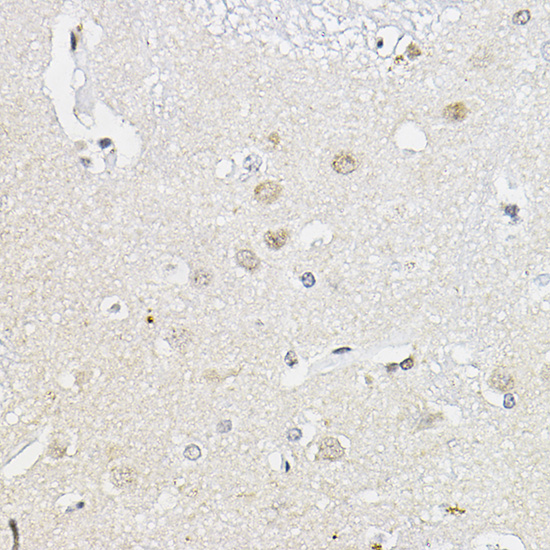 Immunohistochemistry of paraffin-embedded human brain using RING1A Polyclonal Antibody at dilution of 1:100 (40x lens).Perform high pressure antigen retrieval with 10 mM citrate buffer pH 6.0 before commencing with IHC staining protocol.