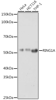 Western blot analysis of extracts of various cell lines using RING1A Polyclonal Antibody at 1:1000 dilution.