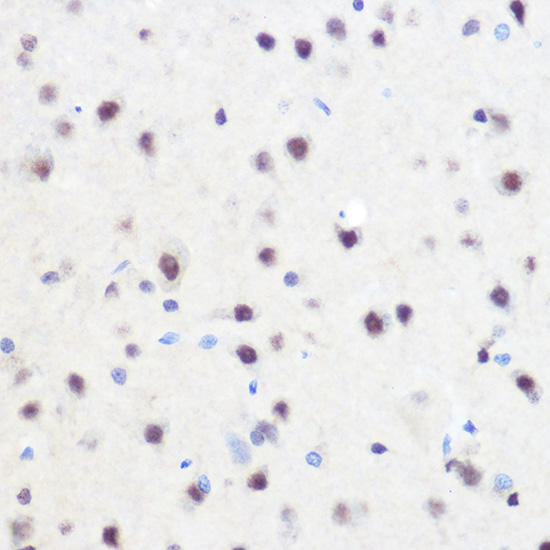 Immunohistochemistry of paraffin-embedded rat brain using ZNF207 Polyclonal Antibody at dilution of 1:100 (40x lens).Perform microwave antigen retrieval with 10 mM Tris/EDTA buffer pH 9.0 before commencing with IHC staining protocol.