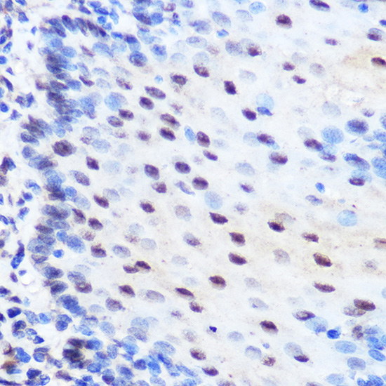 Immunohistochemistry of paraffin-embedded human esophageal using ZNF207 Polyclonal Antibody at dilution of 1:100 (40x lens).Perform microwave antigen retrieval with 10 mM Tris/EDTA buffer pH 9.0 before commencing with IHC staining protocol.