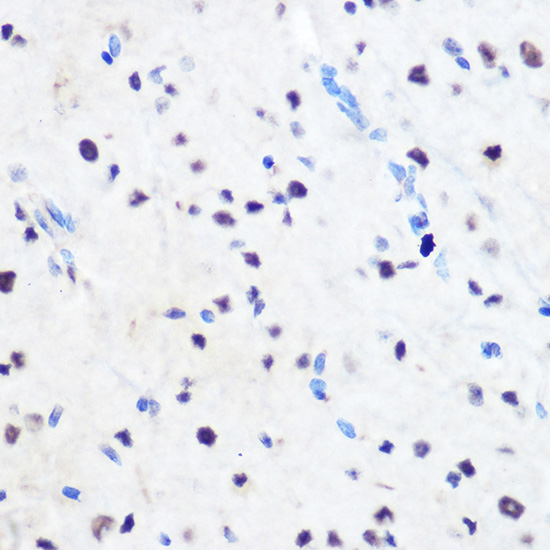 Immunohistochemistry of paraffin-embedded mouse spinal cord using ZNF207 Polyclonal Antibody at dilution of 1:100 (40x lens).Perform microwave antigen retrieval with 10 mM Tris/EDTA buffer pH 9.0 before commencing with IHC staining protocol.