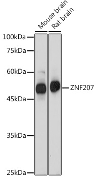 Western blot analysis of extracts of various cell lines using ZNF207 Polyclonal Antibody at 1:1000 dilution.