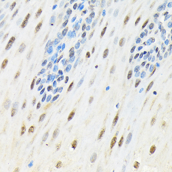 Immunohistochemistry of paraffin-embedded human esophageal using SLBP Polyclonal Antibody at dilution of 1:100 (40x lens).Perform microwave antigen retrieval with 10 mM Tris/EDTA buffer pH 9.0 before commencing with IHC staining protocol.