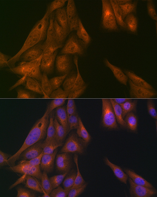 Immunofluorescence analysis of U2OS cells using USP11 Polyclonal Antibody at dilution of 1:100 (40x lens). Blue: DAPI for nuclear staining.