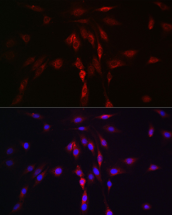 Immunofluorescence analysis of C6 cells using LLGL1 Polyclonal Antibody at dilution of 1:100. Blue: DAPI for nuclear staining.