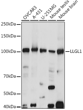 Western blot analysis of extracts of various cell lines using LLGL1 Polyclonal Antibody at 1:1000 dilution.