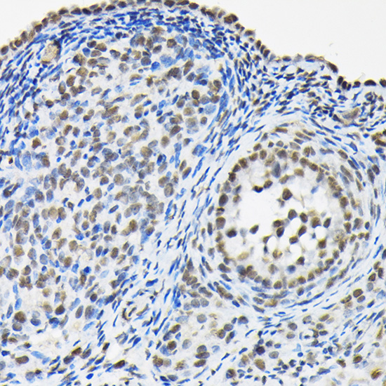 Immunohistochemistry of paraffin-embedded rat ovary using HNRNPA3 Polyclonal Antibody at dilution of 1:100 (40x lens).Perform high pressure antigen retrieval with 10 mM citrate buffer pH 6.0 before commencing with IHC staining protocol.