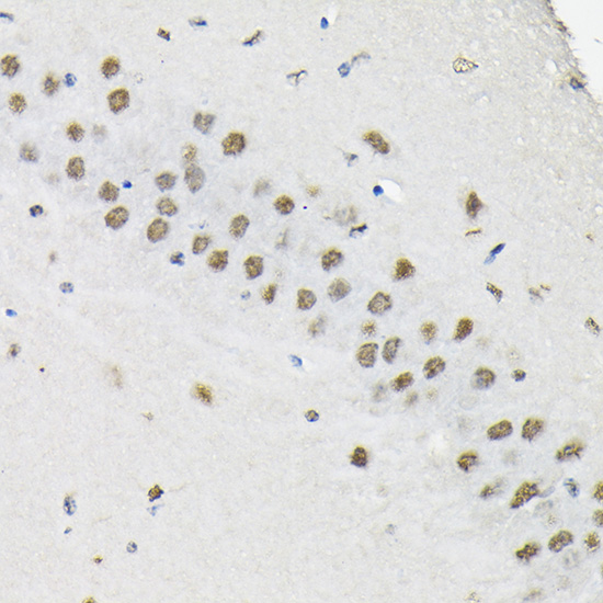 Immunohistochemistry of paraffin-embedded mouse brain using HNRNPA3 Polyclonal Antibody at dilution of 1:100 (40x lens).Perform high pressure antigen retrieval with 10 mM citrate buffer pH 6.0 before commencing with IHC staining protocol.