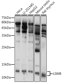 Western blot analysis of extracts of various cell lines using LSM8 Polyclonal Antibody at 1:1000 dilution.