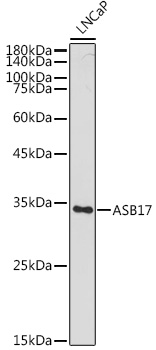 Western blot analysis of extracts of LNCaP cells using ASB17 Polyclonal Antibody at 1:1000 dilution.